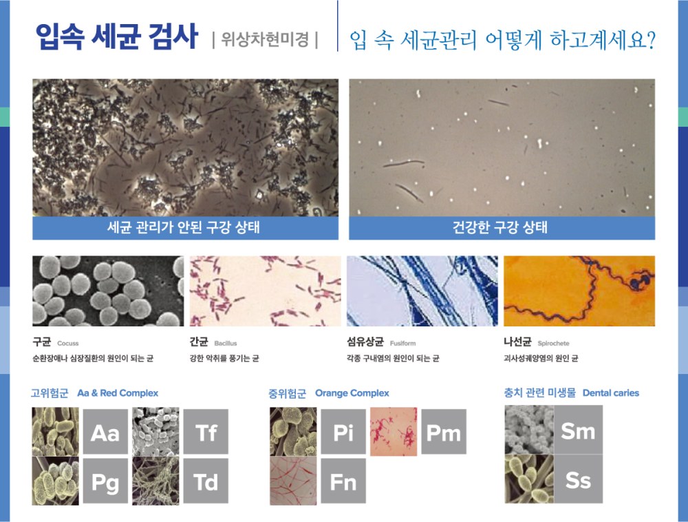 입속 세균의 종류를 정리한 안내 이미지