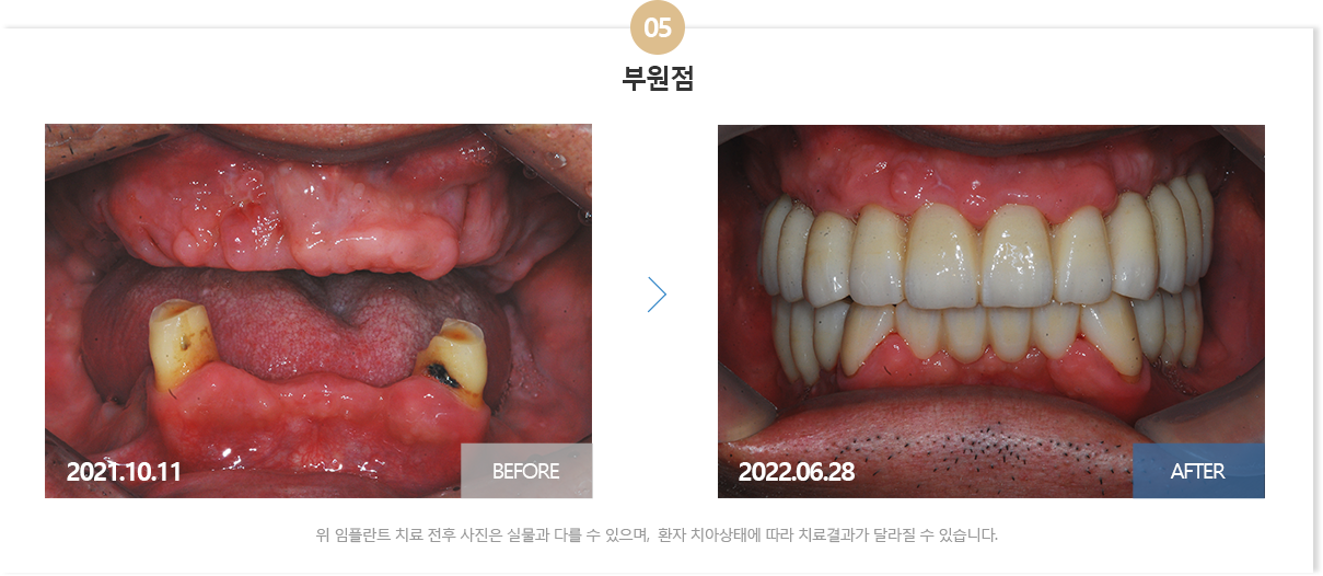 뉴욕치과병원