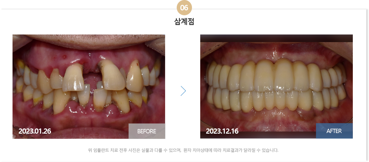 뉴욕치과병원