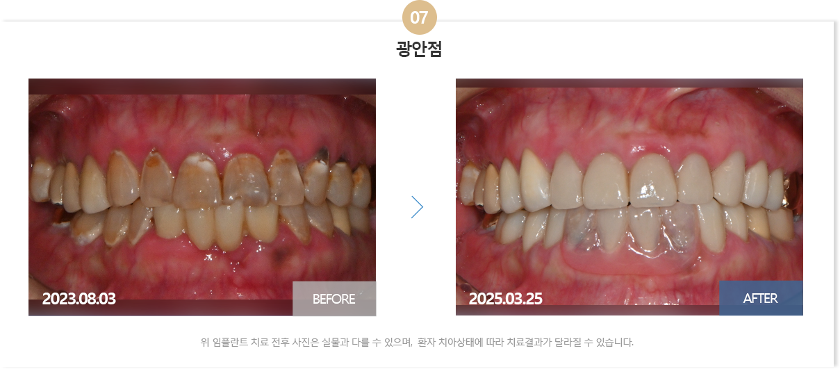 뉴욕치과병원