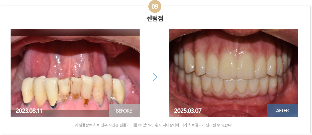 뉴욕치과병원