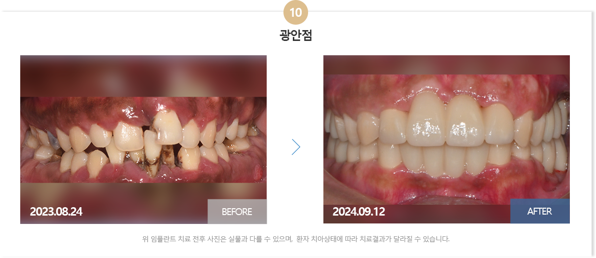 뉴욕치과병원