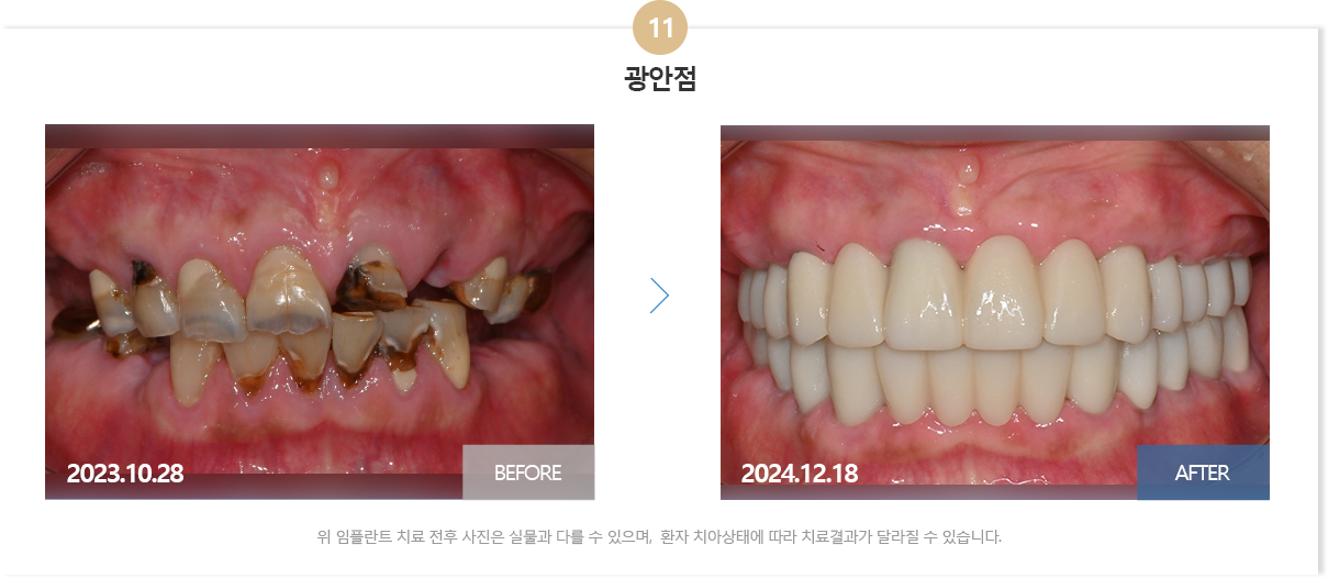 뉴욕치과병원