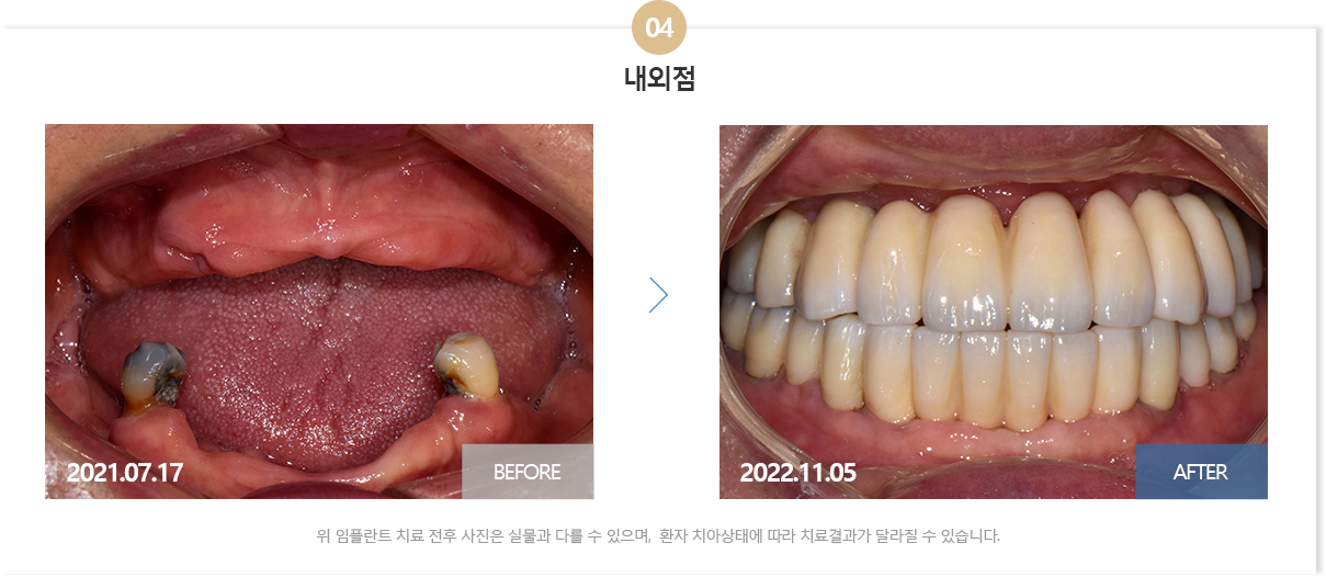 뉴욕치과병원
