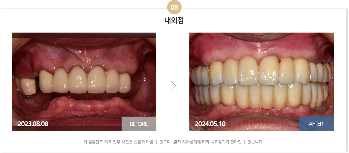 뉴욕치과병원