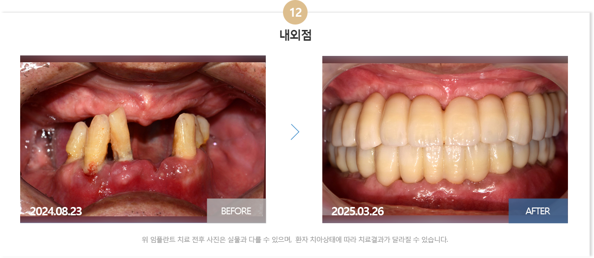 뉴욕치과병원