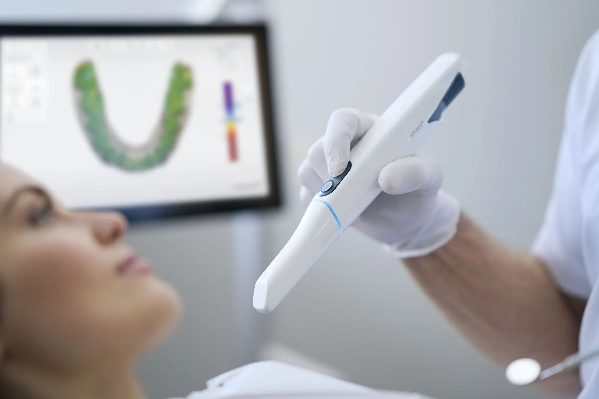 3Shape TRIOS intraoral scanner